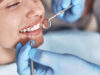 Achieving Flawless Smiles: The Power of Cosmetic Dentistry Achieving-Flawless-Smiles